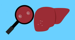 Hepatitis of unknown origin found in Children