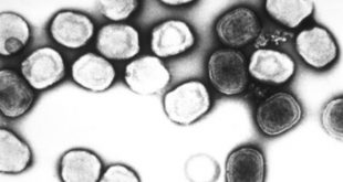 Monkeypox: Endemic or Epidemic
