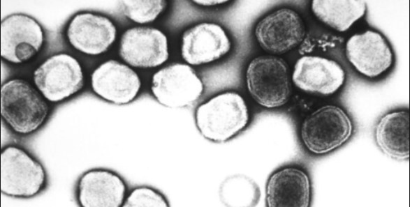 Monkeypox: Endemic or Epidemic