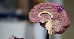 Awake brain surgery in Pakistan
