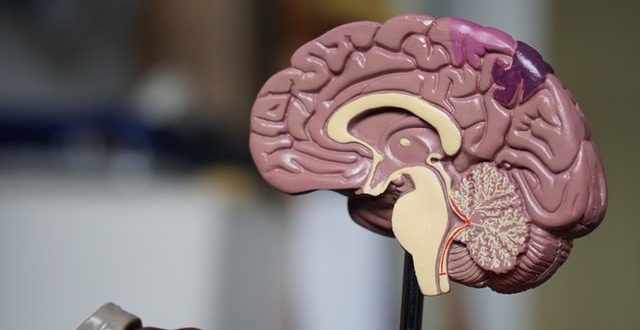 Awake brain surgery in Pakistan
